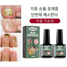 무좀