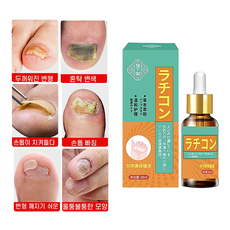 발톱 무좀 치료제 손톱 발톱 리페어, 30.01ml, 1개