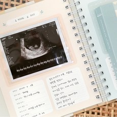 태교 태아초음파 앨범 육아 임신 일기 기록하는 태아사진 임산부 신생아 성장 출산 기록, 초음파앨범_도트