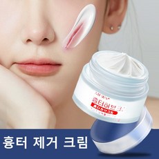 AKOLA 50g 흉터허브 크림 여드름 자국 옅어짐 화상 흉터 제거 흉터 제거 수술 흉터 제거 크림 50g 1개