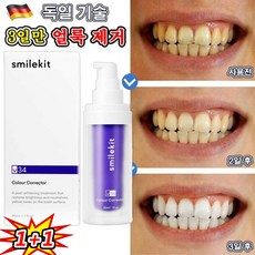 (한국셀러/본토출하) v34 셀프치아미백 구강 위생 클렌징 /환불 보장 치아 추천 화이트닝 치약