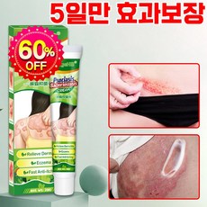[빠른효과] 피부 건선 연고 가려움증 한포진 습진 알레르기 발포 습진 발진 연고 크림, 1개, 20g