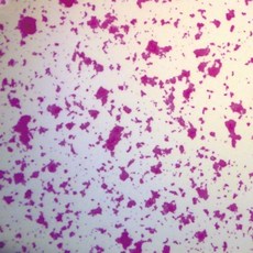 현미경세균표본