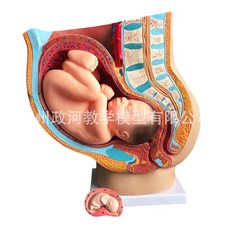 팔레스타인비극사