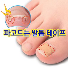 더로만 파고드는 발톱 관리 테이프