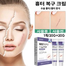 흉터 복원 흉터 제거 피부 재생 흉터 복원 및 완화, 1개, GH03