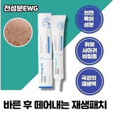 엉덩이종기