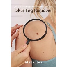 Skin Tag Remover: Natural Remedies for Removing Skin Tag Safely Paperback, Charis Press, English, 9781637500767