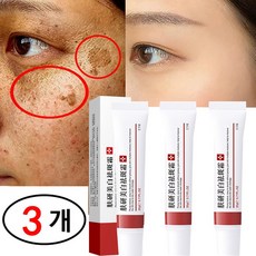 [정품 유효]화이트닝 주근깨 크림 기미 크림 제거 다크 스팟 제거 멜라닌 에이징 스킨 whitening freckle cream, 20g, 3개 - 피코탄st