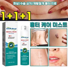 [피부과 전용] 흉터 케어 미스트 수술흉터 화상물집 쌍꺼풀흉터 제왕절개흉터 흉터제거연고 재생크림 과민성 흉터/흉터 증식 여드름흉터