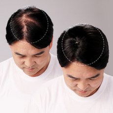 남성부분정수리가발