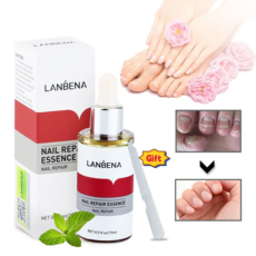 [국내배송] LANBENA 무좀 발톱무좀약 발톱무좀 치료 조갑사상균증 치료, 1.5ml*2, 2개