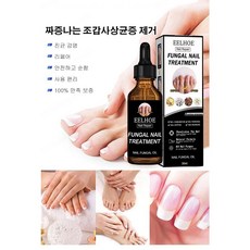 발톱무좀치료제 TOP01