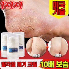 [당일발송] 1/1+1/2+2 바세린 발각질제거 크림 풋크림 풋케어 스틱 발 뒤꿈치 굳은살 제거 각질연화제 고보습 리페어, 3개, 1개입