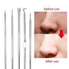 코 피지 블랙헤드 제거 리무버 도구 여드름 흠집 추출기 바늘 트위터 모공 클리너 페이스 클렌징 스킨 케어, [02] BA2 Style B