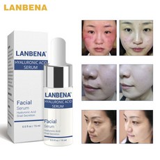 히알루 론산 에센스 세럼 여드름 치료 스킨 케어 화이트닝 크림 페이스 안티 윙클 즈 에이지리스 모이스춰 라이징 달팽이 에센스, 미국