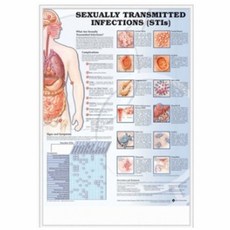 (Anatomical) 성병감염차트 사이즈 54x76 NO.8492, 액자추가