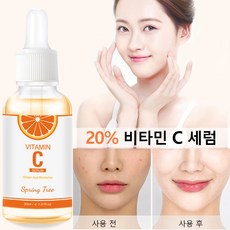 Spring Tree 피부에 촉촉함을 주다 비타민 C 순수 비타씨 세럼 에센스 탄력앰플, 1개, 30ml - 레츠큐어비타민