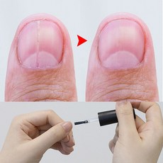 1초 손톱영양제 강화제 네일케어, 3개