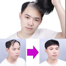 m자탈모가발