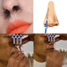 코털왁싱