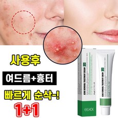 [당일배송] 1+1 여드름 제거 연고 리페어 크림 얼굴 뾰루지 치료 문제피부 케어연고