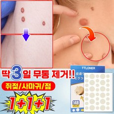 쥐젖제거 TOP01