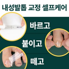 내성발톱교정기