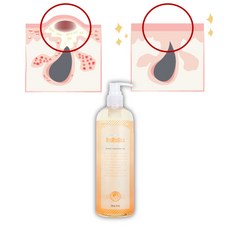각질용해제-추천-상품
