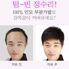 20대남자가발