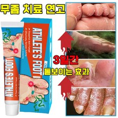 [국내배송] 발 연고 발냄새 제거 연고 발 가려움 발가락 진균 치료, 1개, 20g - 사타구니무좀약