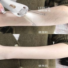 다리털뽑기