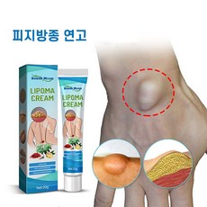 피지낭종 연고 피부 표피낭종제거 지방종 완화크림, 1개