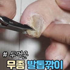 무좀발톱깎기