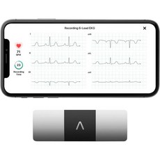 Kardia Mobile 6 Lead Personal EKG Monitor 심장의 6가지 보기 AFib 불규칙 부정맥 감지 30초 만 즉각적인 결과 대부분의 스마트폰과 작동 F