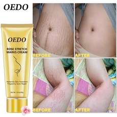 비오템튼살오일