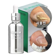 리즈 푸스킬라 30ml 손발톱 영양제 전문 리페어 세럼 강화제