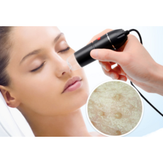 두피촬영카메라