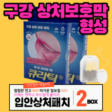 넣입밴드
