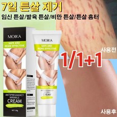 [한정세일 1/1+1] 산후 튼살크림 튼살 완화 바디크림 마크 크림 임산부 피부 집중 케어 임신 튼살 잔주름 개선 멀티 크림