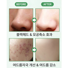 블랙헤드아웃고체스틱