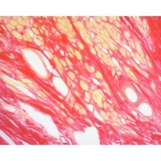 Picrosirius Red Stain Pack 콜라겐용 500ml