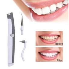 초음파스케일러