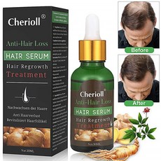 체리올 기능성헤어트리트먼트 30ml 1팩 머리발모제 효과 세럼