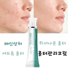 여드름흉터