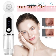 모공 추출 헤드 스킨 케어용 클리너 흡입 충전식 얼굴 개의 블랙 진공 USB 도구