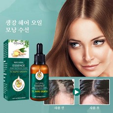탈모치료기렌탈