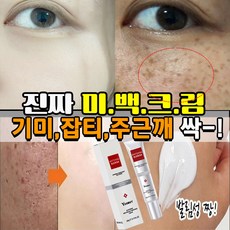 [국내배송] 1+1/2+2 기미 제거 크림 검버섯 주근깨 잡티 피부 색소침착 반점 개선 미백 크림