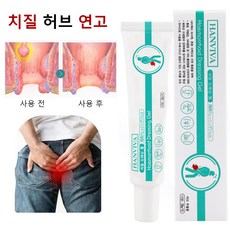 항문 및 사타구니 종합 연고 즉각 케어 크림 항문 관리 솔루션 가려움증 등 여러가지 문제 완화, 20g, 1개