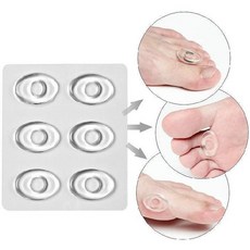 실리콘 6p 발보호 패치 티눈 패드 굳은살 방지 물집 패드 밴드 발바닥 물집 패드, 6개, 2팩